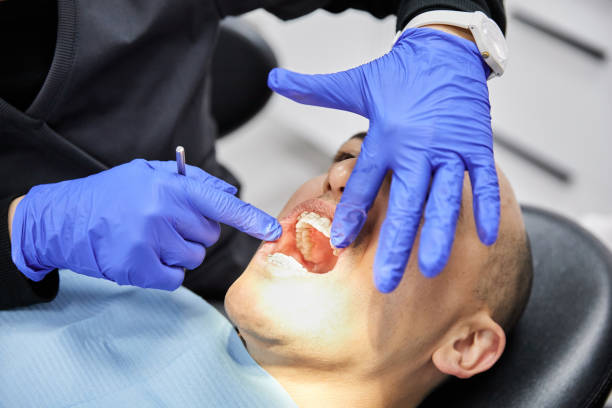 Best Emergency Dental Extractions in Lyncourt, NY